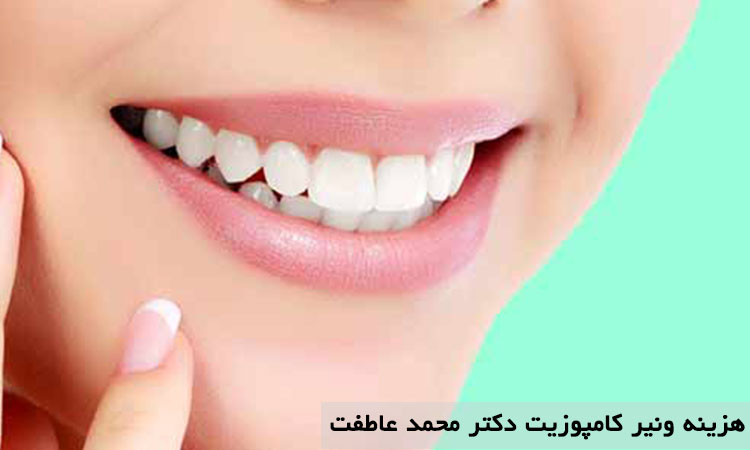 ونیرکامپوزیت دندان