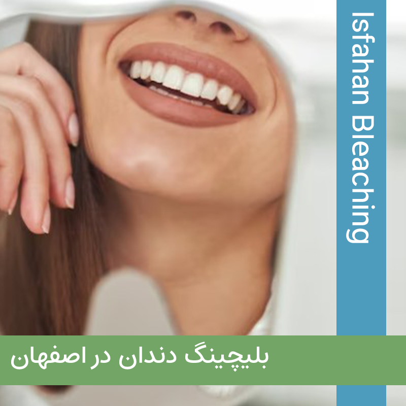 دکتر بلیچینگ دندان در اصفهان