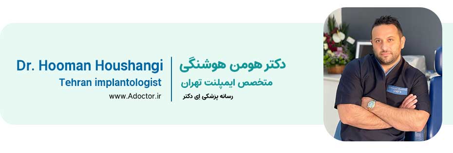 دکتر هوشنگی دندانپزشک ایمپلنت در تهران