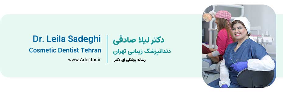 دکتر صادقی دندانپزشک زیبایی ماهر تهران