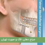 جراح فک دهان و صورت در تهران