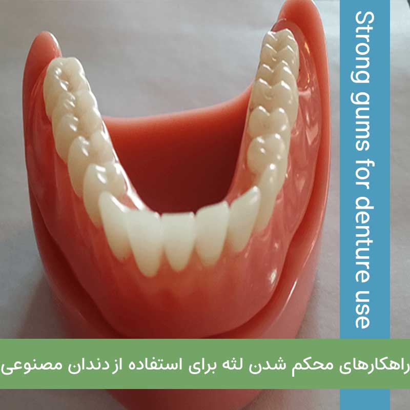 راهکار های محکم شدن لثه برای استفاده از دندان مصنوعی